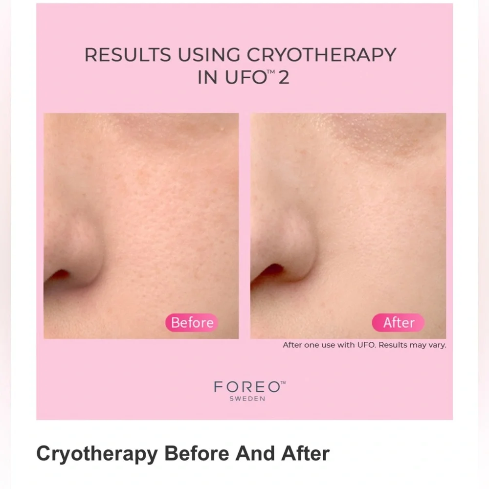NWT FOREO UFO 2